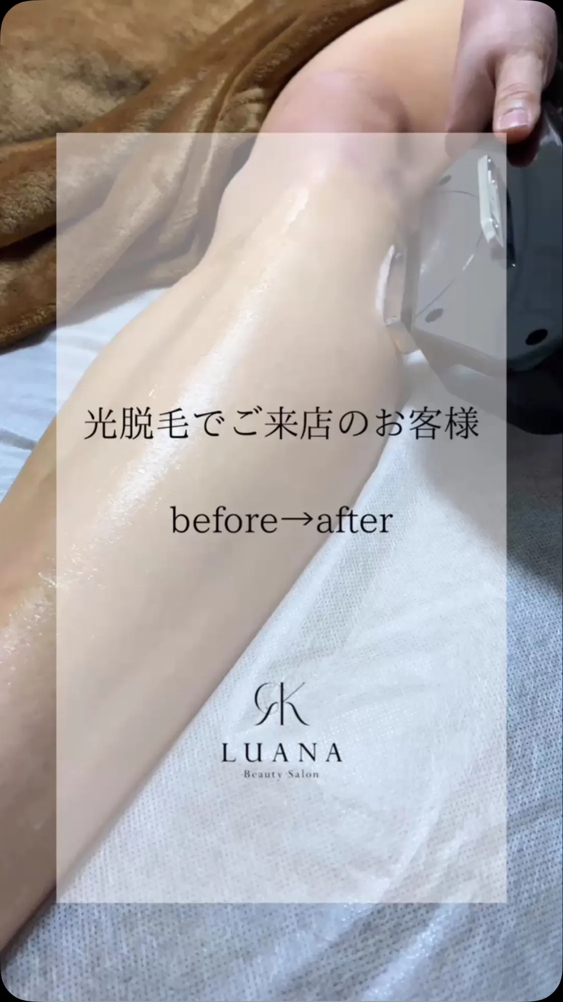 【✨脱毛、始めるなら今！✨】