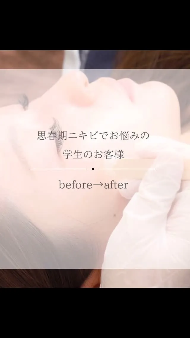 📸【フェイシャルワックスBefore / After】