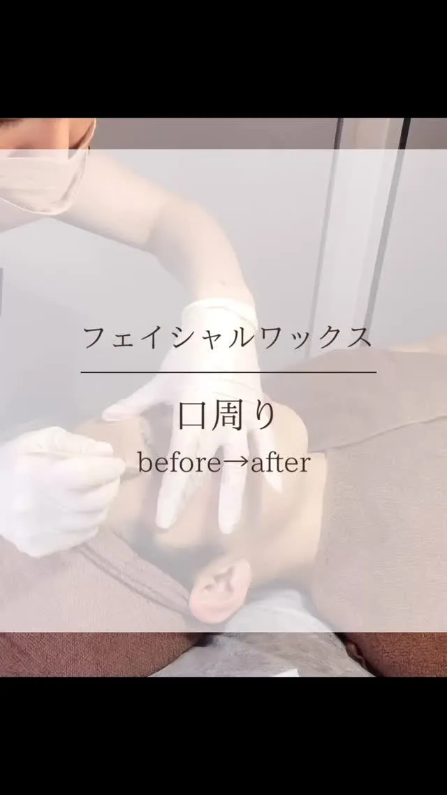 【口周りのフェイシャルワックス】