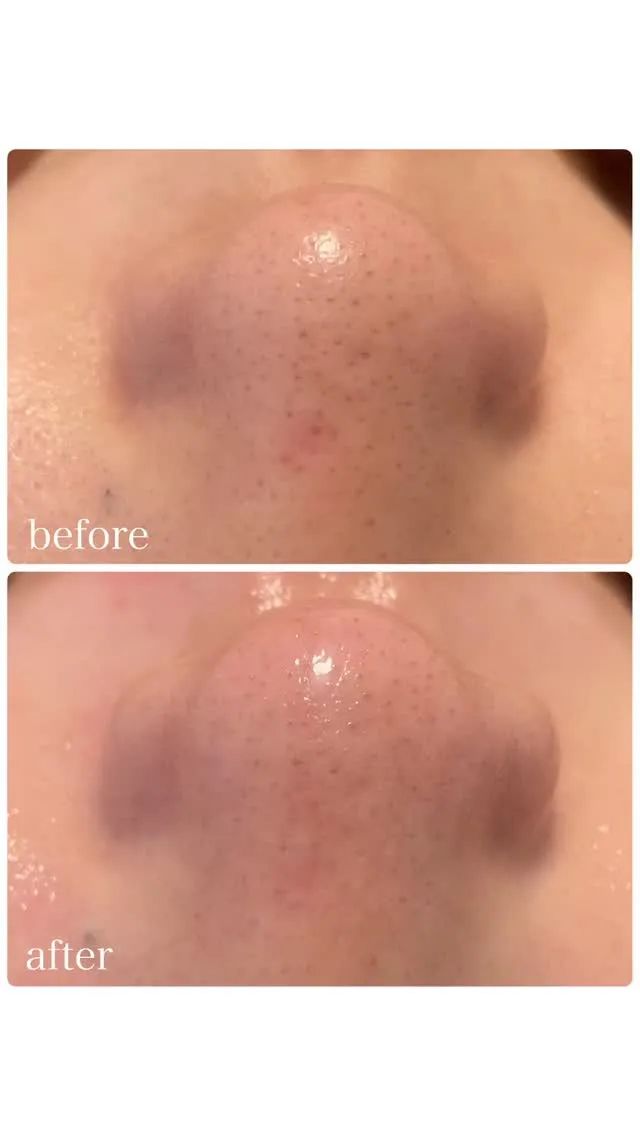 【フェイシャルWAX💆‍♀️】