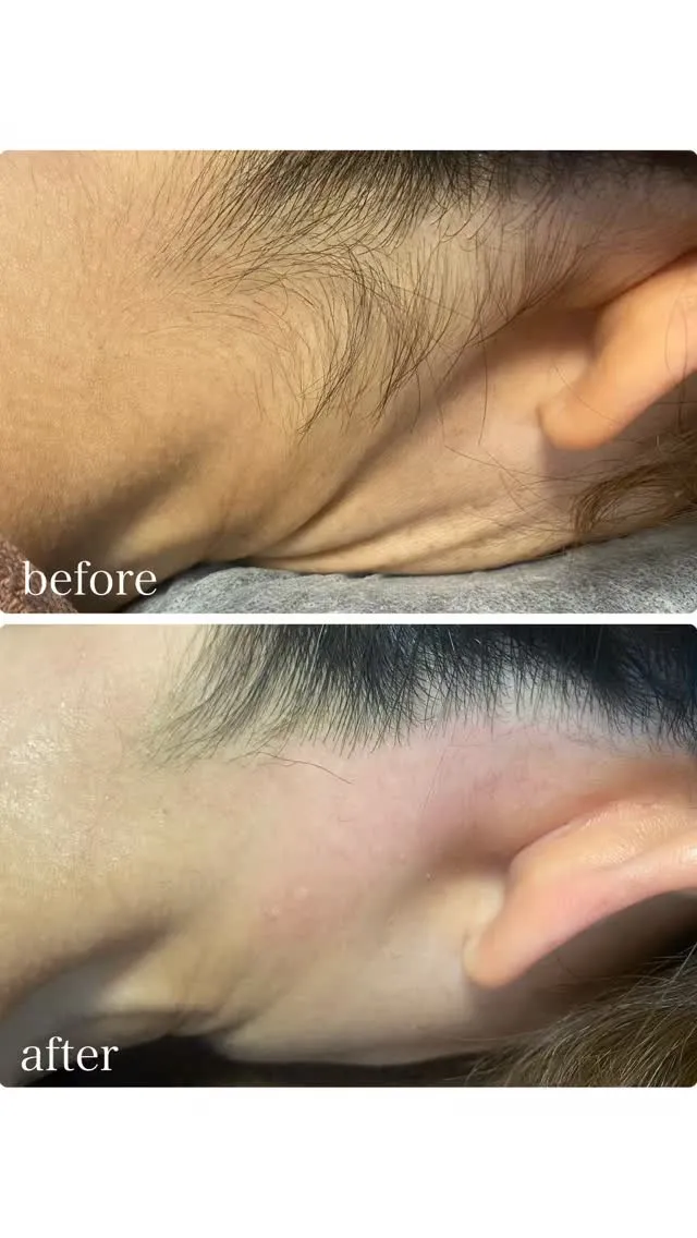 【うなじWAX🧡】