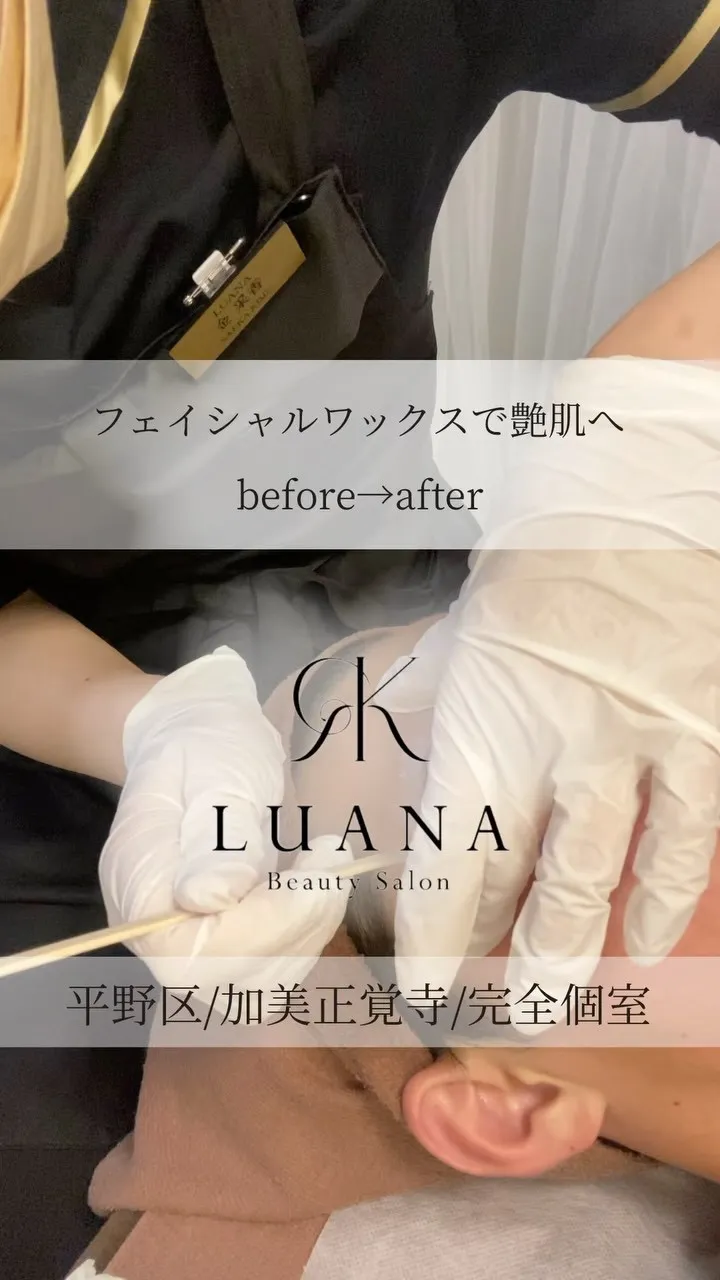 【フェイシャルワックス💆‍♀️✨】