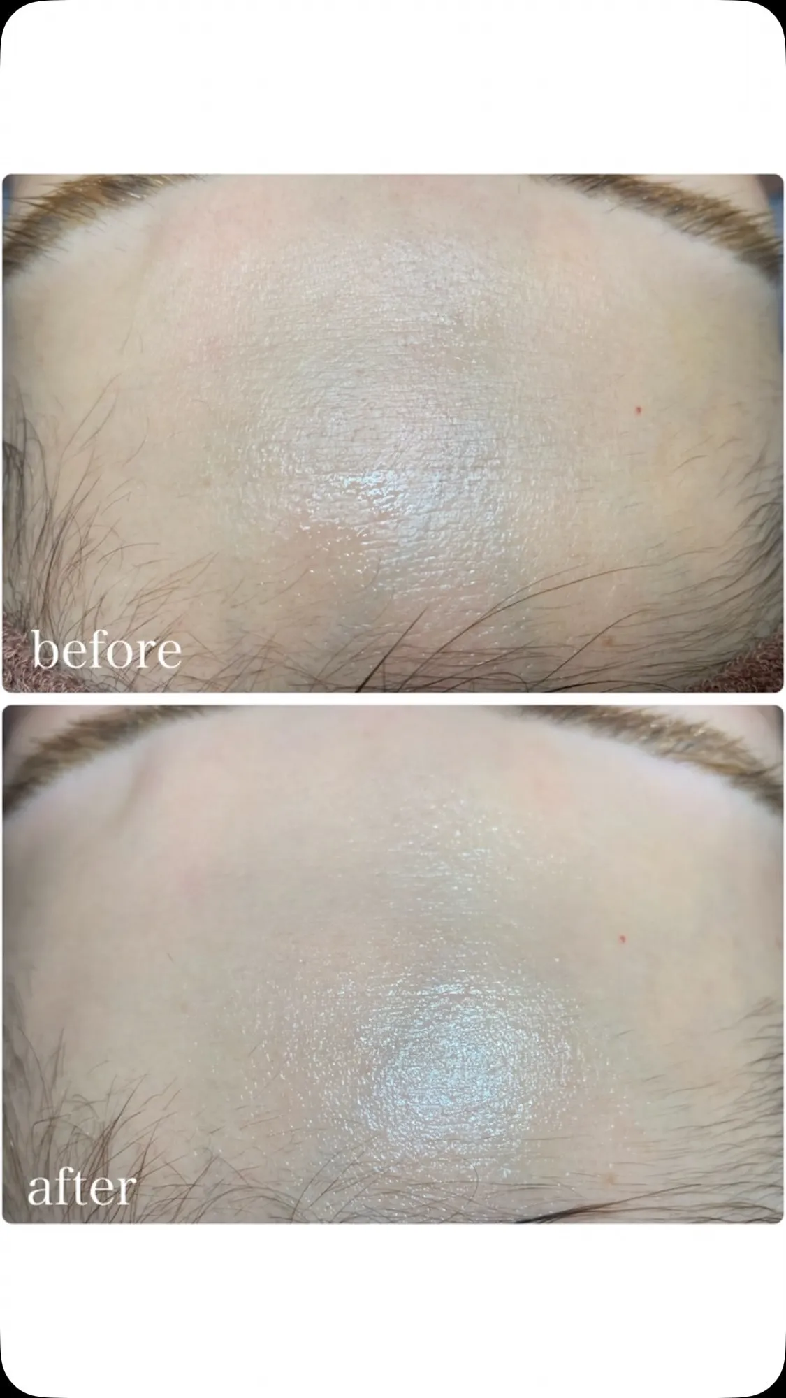 【フェイシャルワックス💆‍♀️✨】